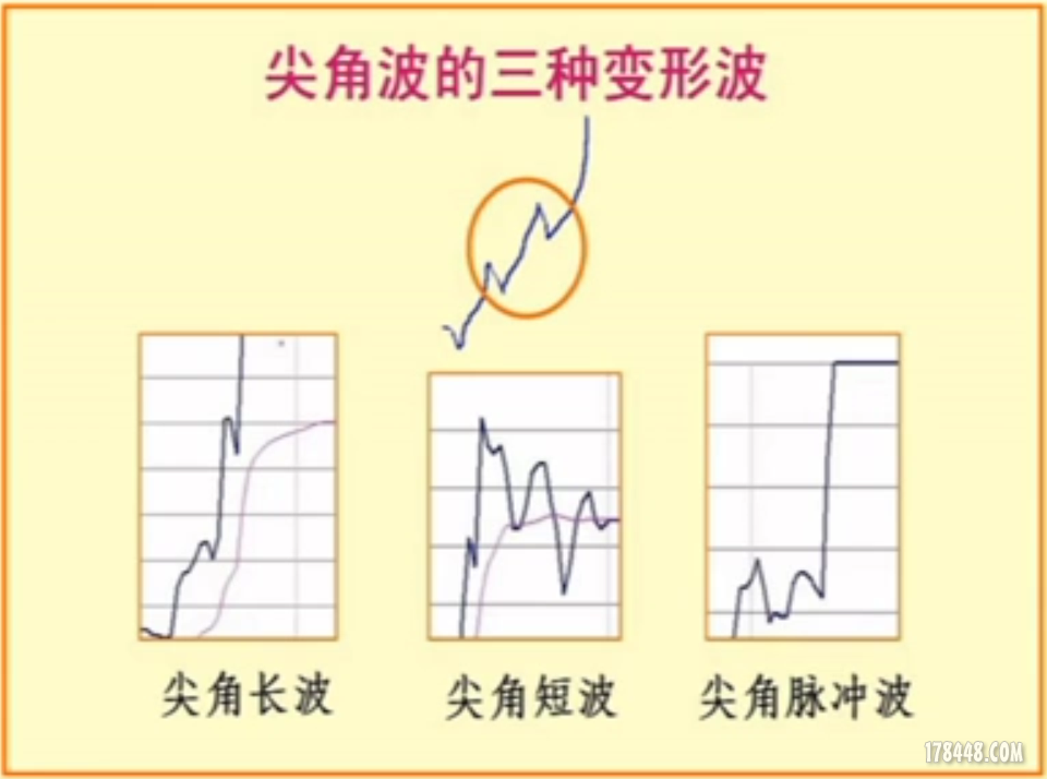 尖角波.png