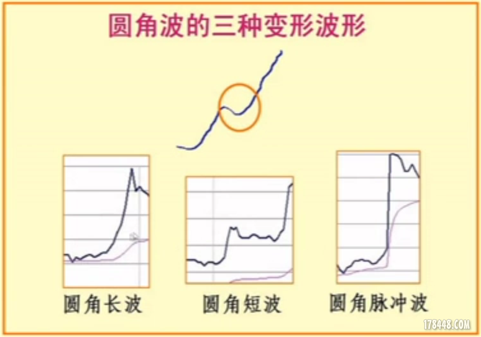 圆角波.png